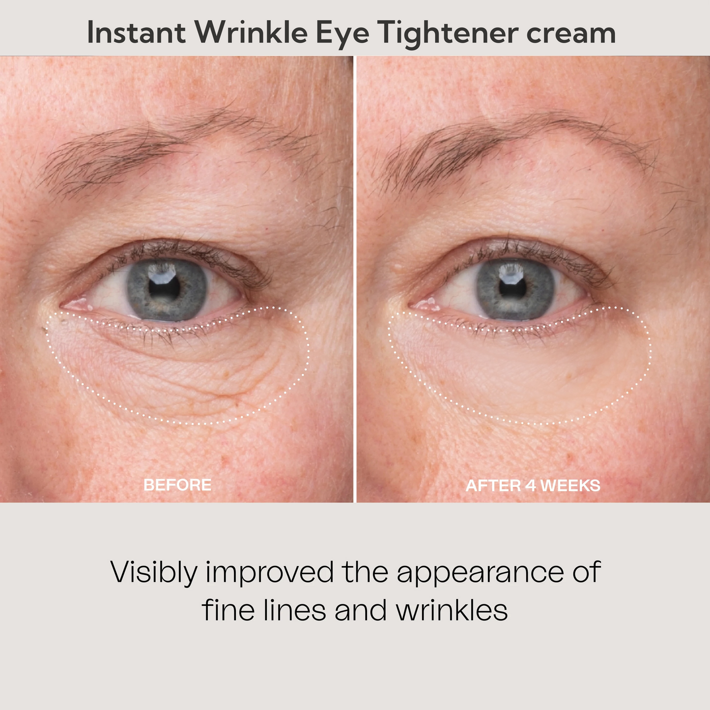 💯Tiworld™🔥Instant Wrinkle Eye Tightener cream