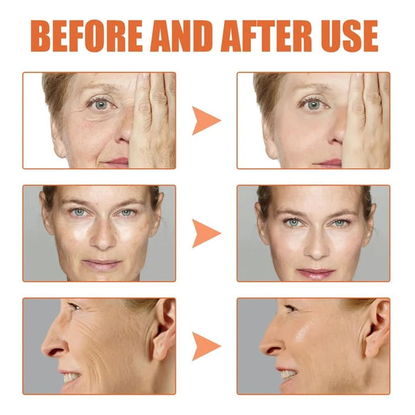 ✨Last Day Promotion 70% OFF✨-Tiworld™ Botox Facial Essence