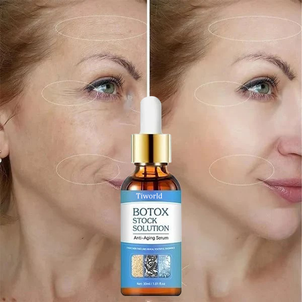 ✨Last Day Promotion 70% OFF✨-Tiworld™ Botox Facial Essence