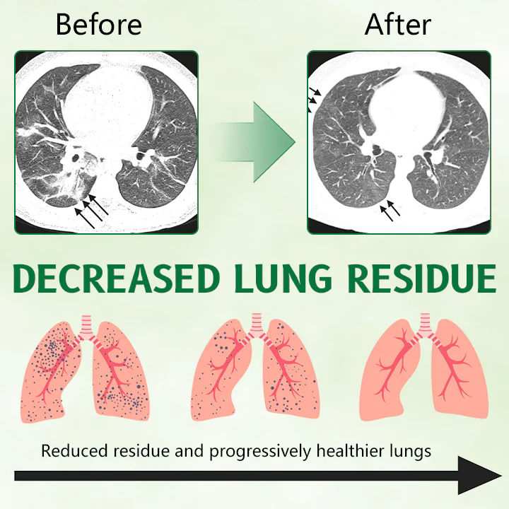 SEAGRIL™ Herbal Antibacterial Lung Cleansing Nasal Spray