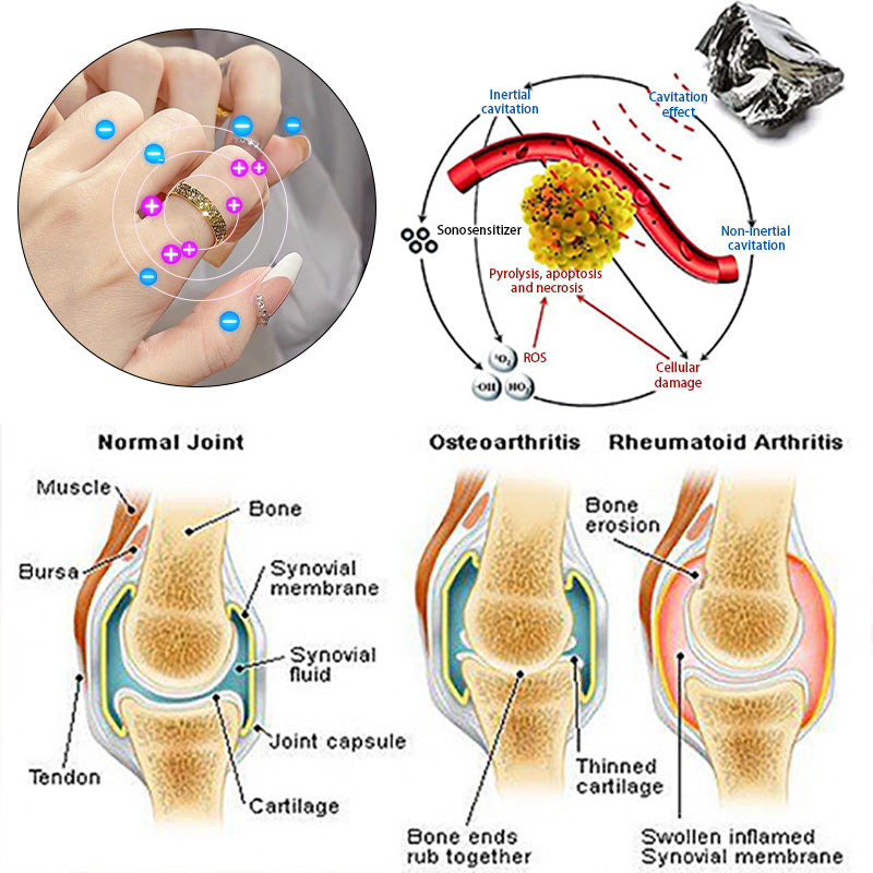 LAST DAY SALE-90% OFF💖Tiworld  Lymphatic Magnetic Therapy Ice Pattern Ring