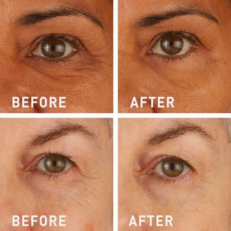 💯Tiworld™🔥Instant Wrinkle Eye Tightener cream